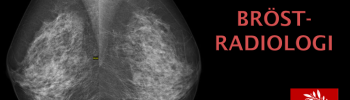 bröstradiologi, kurs bröstradiologi, kurs mammografik, mammografi för röntgensjuksköterskor, kurs mammografi undersökterska, kurs bröst, bröstradiologi kurs