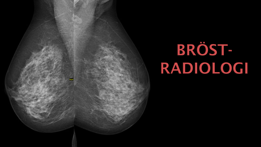 bröstradiologi, kurs bröstradiologi, kurs mammografik, mammografi för röntgensjuksköterskor, kurs mammografi undersökterska, kurs bröst, bröstradiologi kurs