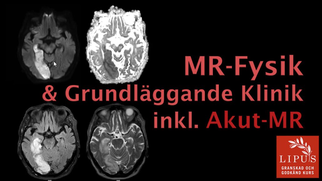 mr-fysik kurs, kurs mr fysik. kurs mr-fysik, kurs mr radiologi, kurs i mr radiologi, st kurs radiologi, kurs mr, kurs mr-fysik klinik