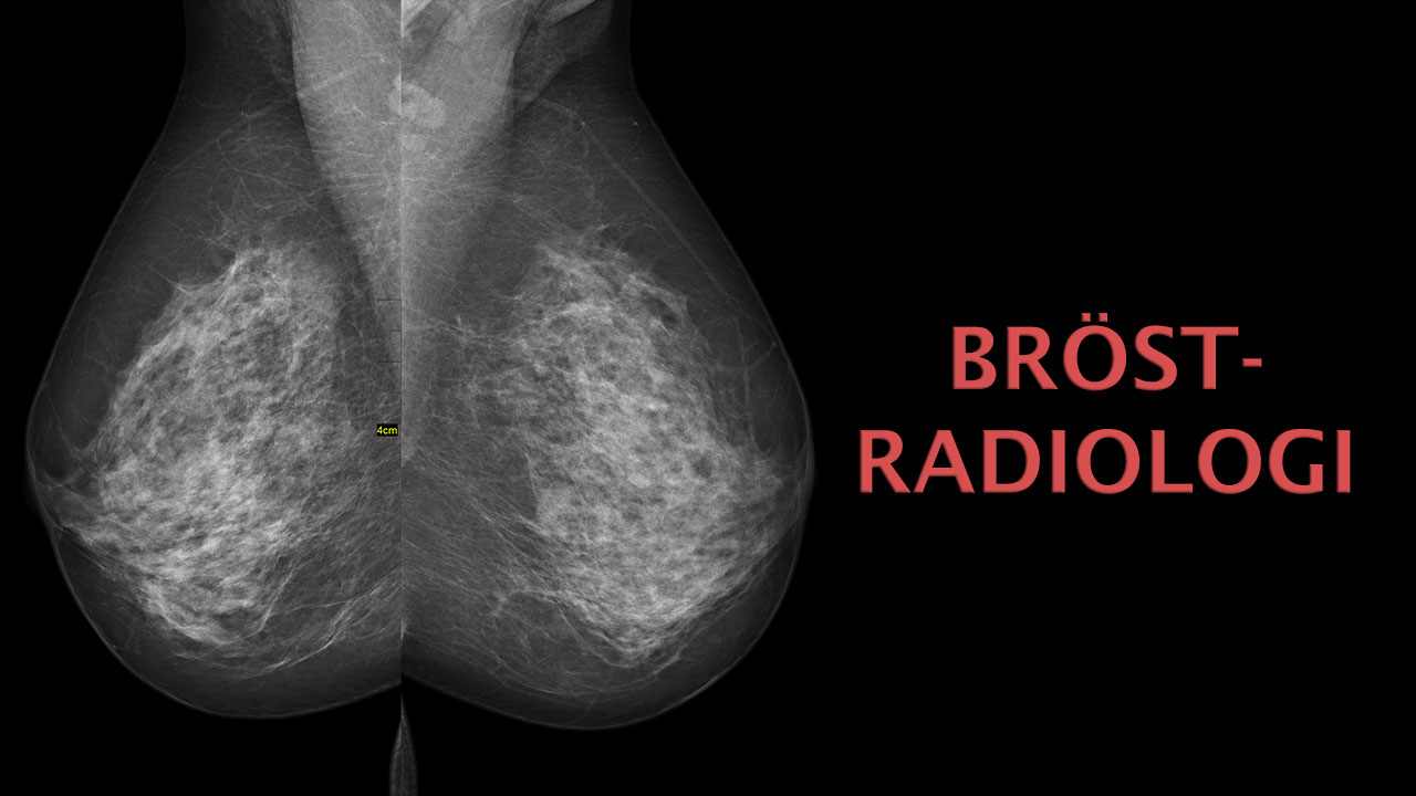 Bröstradiologi course image