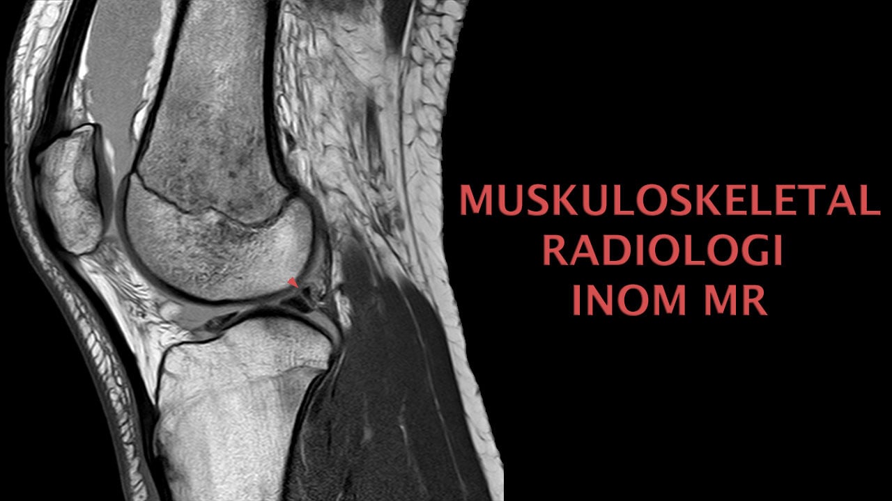 MSK-Radiologi (MR av Leder) course image