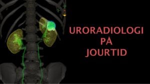 uroradiologi, urogenital kurs radiologi, uroradiologi kurs, urologikurs radiologi, radiologi utbildning på nätet, radiologikurs online