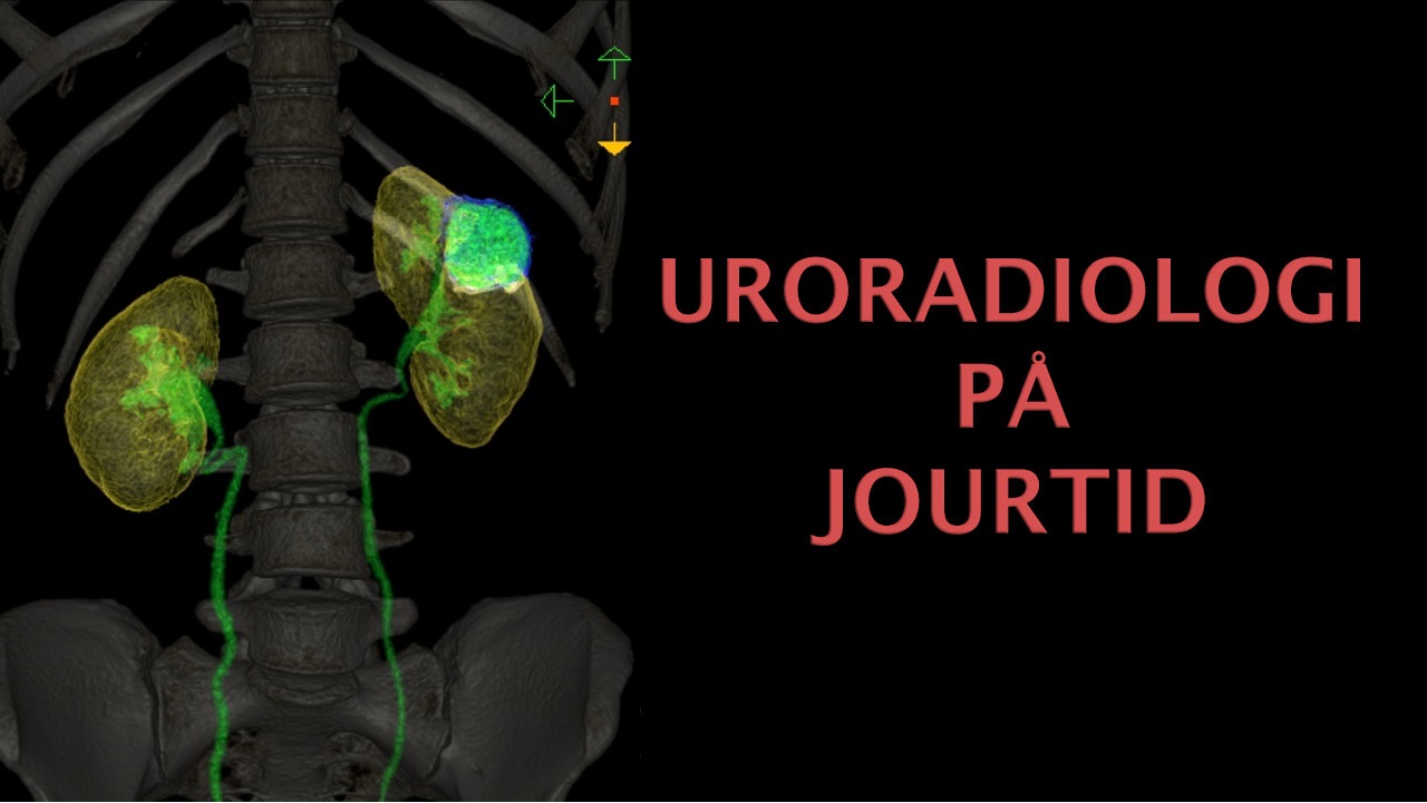 Uroradiologi På Jourtid course image